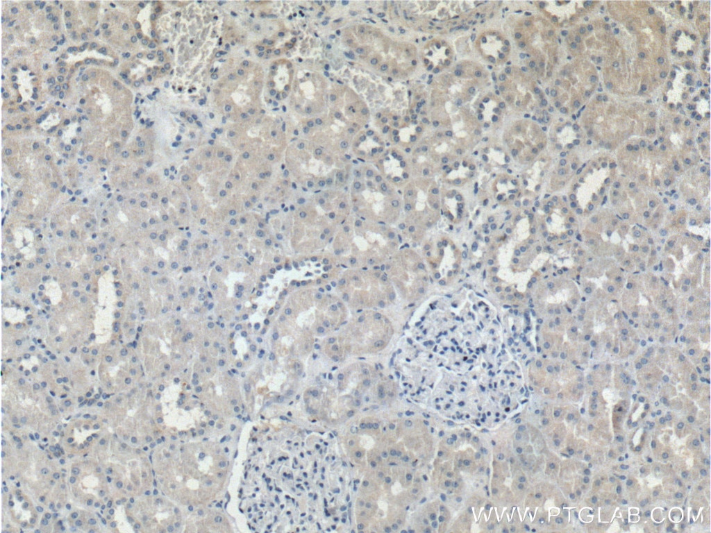 Immunohistochemistry (IHC) staining of human kidney tissue using TRIM47 Polyclonal antibody (26885-1-AP)