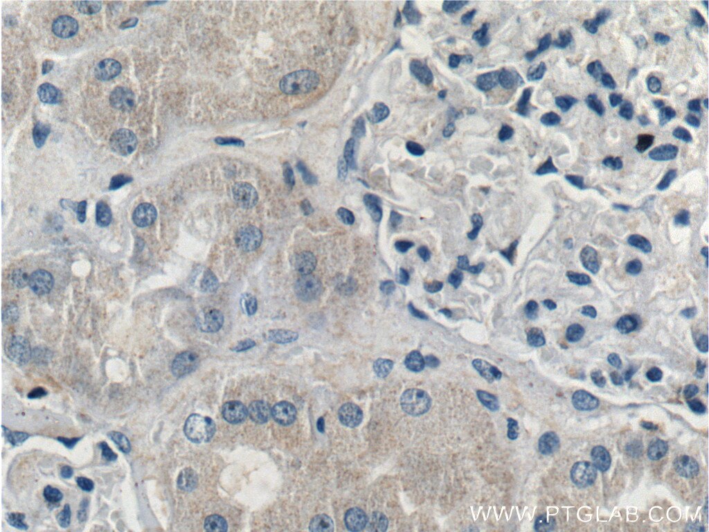 Immunohistochemistry (IHC) staining of human kidney tissue using TRIM47 Polyclonal antibody (26885-1-AP)