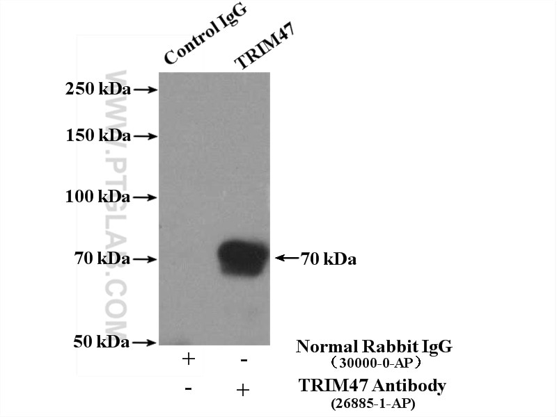 Immunoprecipitation (IP) experiment of U2OS cells using TRIM47 Polyclonal antibody (26885-1-AP)