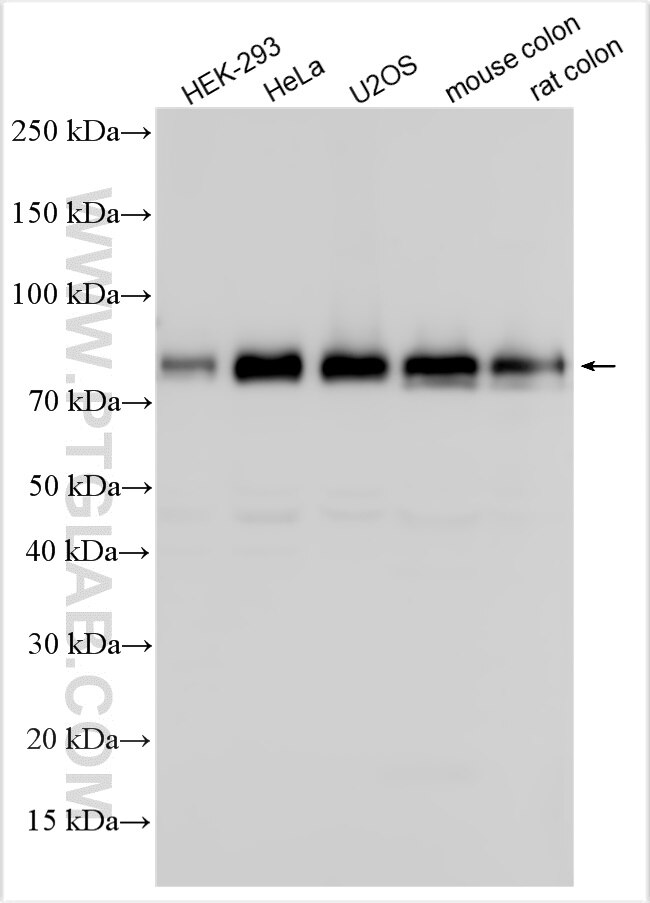 Western Blot (WB) analysis of various lysates using TRIM47 Polyclonal antibody (26885-1-AP)