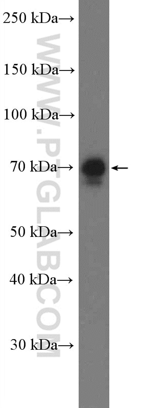 Western Blot (WB) analysis of U2OS cells using TRIM47 Polyclonal antibody (26885-1-AP)