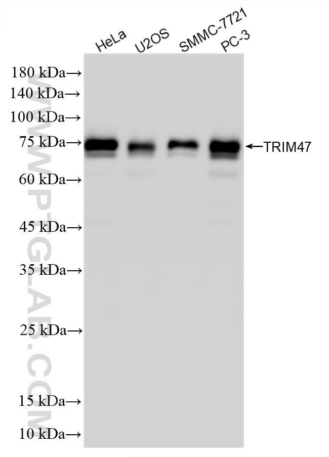 Western Blot (WB) analysis of various lysates using TRIM47 Recombinant monoclonal antibody (86728-1-RR)
