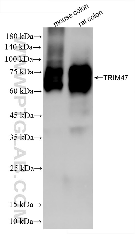 Western Blot (WB) analysis of various lysates using TRIM47 Recombinant monoclonal antibody (86728-1-RR)