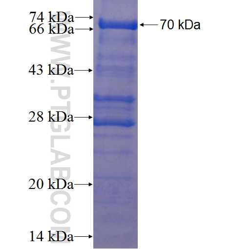 TRIM47 fusion protein Ag22868 SDS-PAGE