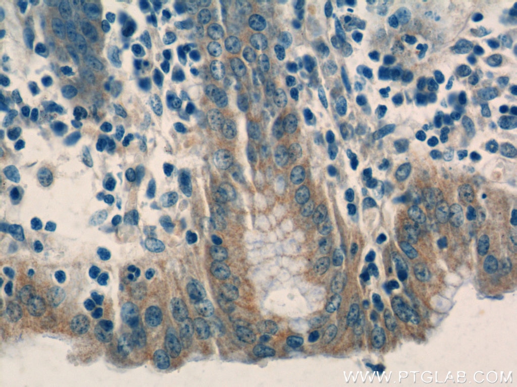 Immunohistochemistry (IHC) staining of human stomach tissue using TRIM5 Polyclonal antibody (11476-1-AP)