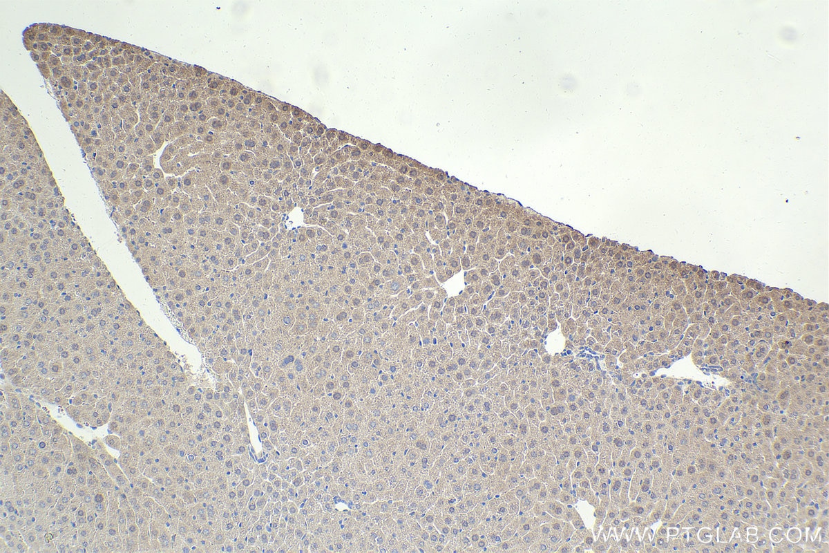 Immunohistochemistry (IHC) staining of mouse liver tissue using TRIM5 Polyclonal antibody (11476-1-AP)