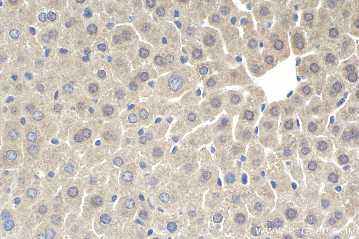 Immunohistochemistry (IHC) staining of mouse liver tissue using TRIM5 Polyclonal antibody (11476-1-AP)