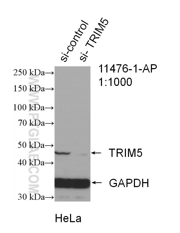 Western Blot (WB) analysis of HeLa cells using TRIM5 Polyclonal antibody (11476-1-AP)