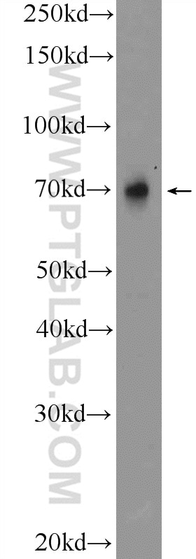 Western Blot (WB) analysis of mouse stomach tissue using TRIM5 Polyclonal antibody (11476-1-AP)