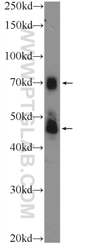 Western Blot (WB) analysis of MKN-45 cells using TRIM5 Polyclonal antibody (11476-1-AP)