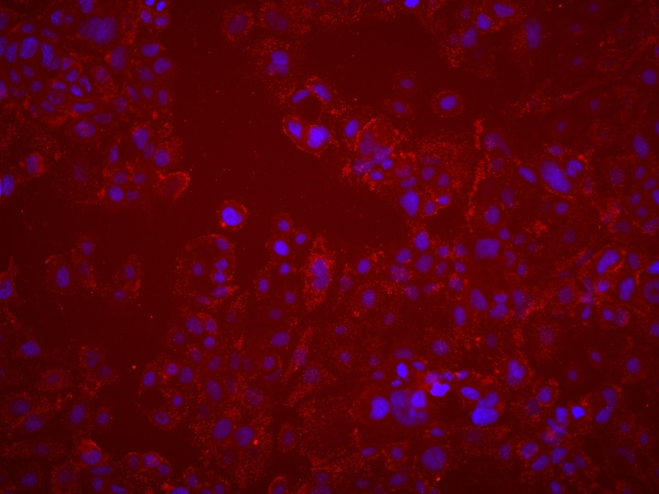 Immunofluorescence (IF) / fluorescent staining of HT-1376 cells using TRIM5 Monoclonal antibody (67492-1-Ig)