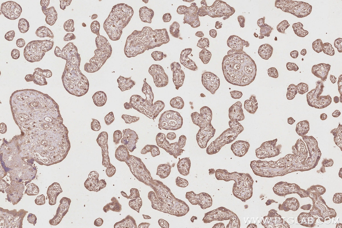 IHC staining of human placenta using 67492-1-Ig Immunohistochemistry (IHC) staining of human placenta tissue using TRIM5 Monoclonal antibody (67492-1-Ig)