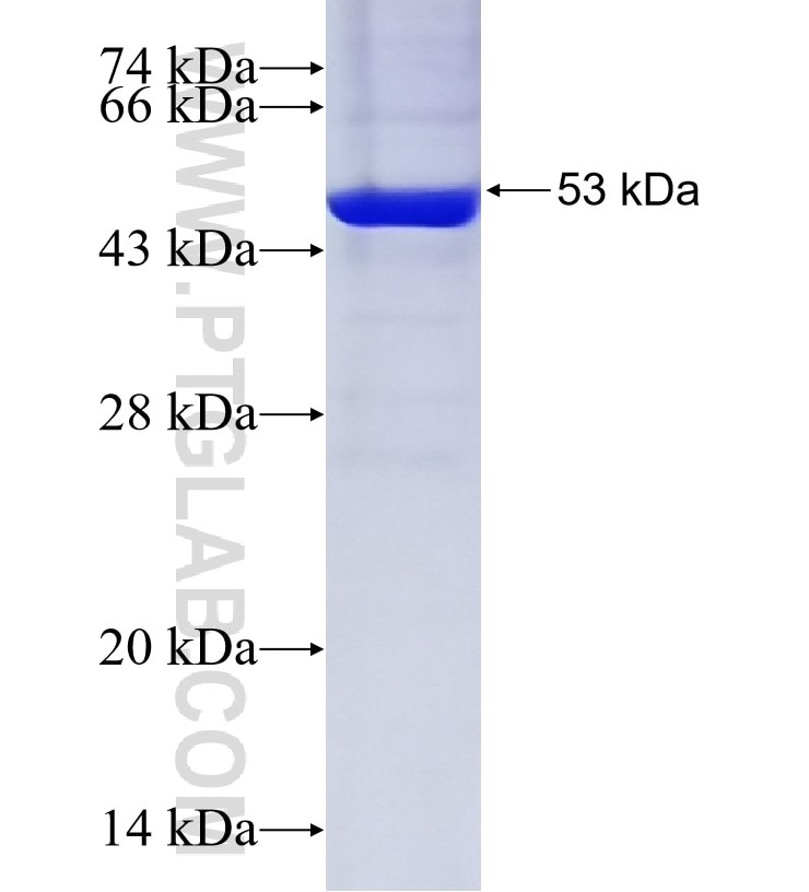 TRIM50 fusion protein Ag34637 SDS-PAGE TRIM50 fusion protein Ag34637 SDS-PAGE