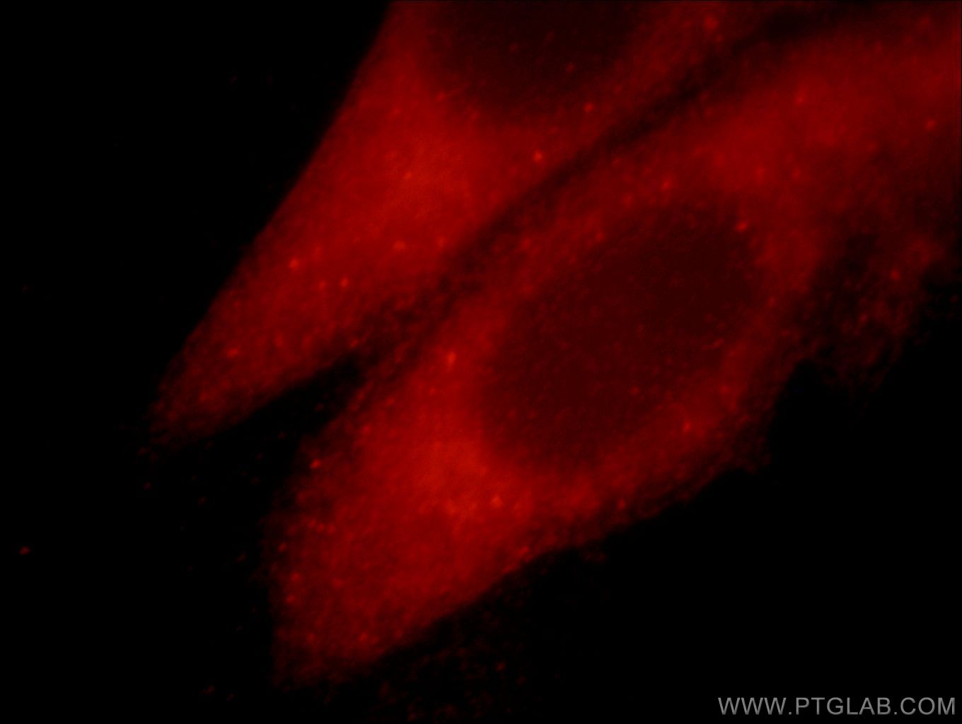 Immunofluorescence (IF) / fluorescent staining of HepG2 cells using TRIM54 Polyclonal antibody (21074-1-AP)