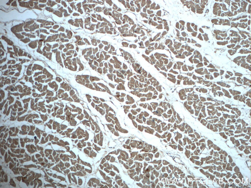 IHC staining of human heart using 21074-1-AP