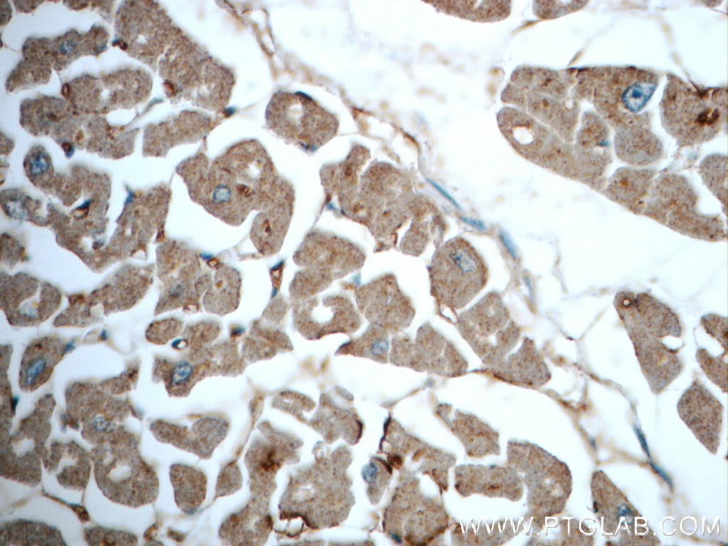 Immunohistochemistry (IHC) staining of human heart tissue using TRIM54 Polyclonal antibody (21074-1-AP)