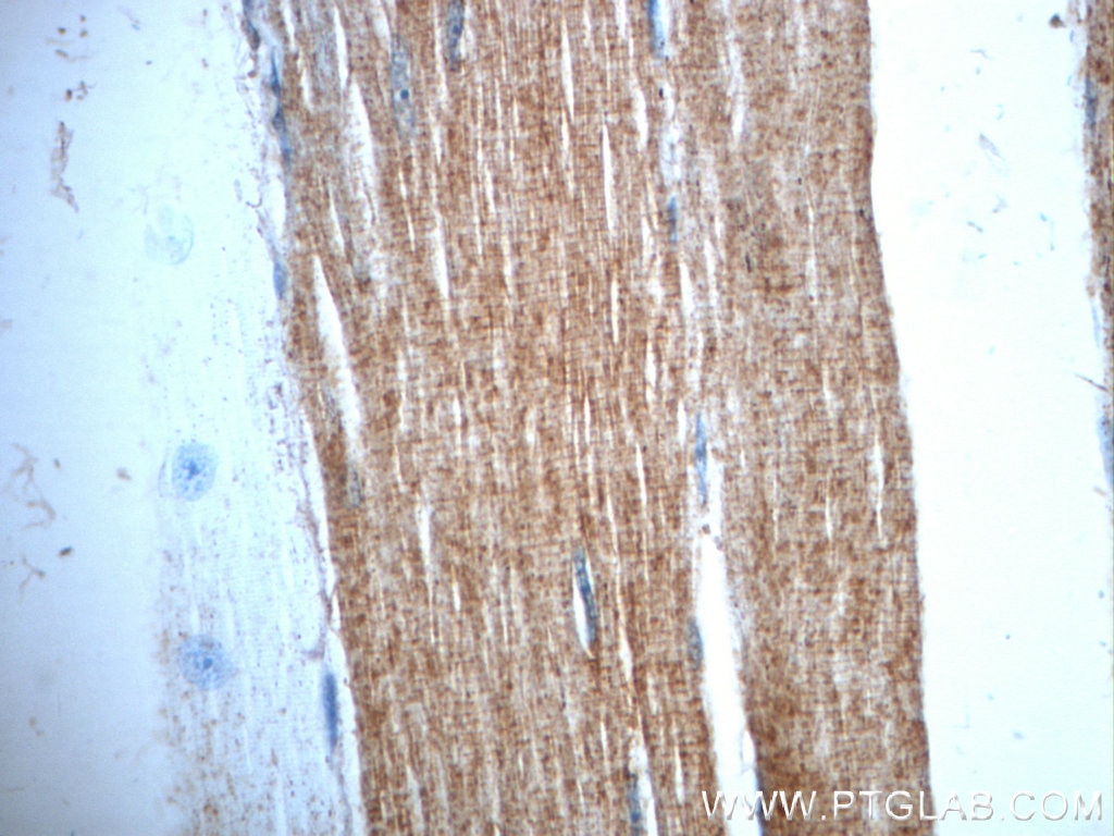 Immunohistochemistry (IHC) staining of human skeletal muscle tissue using TRIM54 Polyclonal antibody (21074-1-AP)