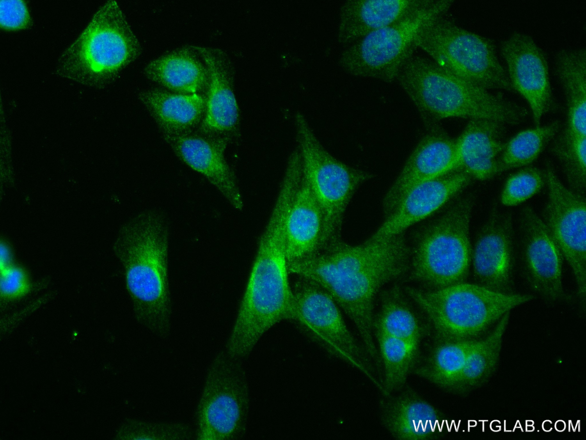 Immunofluorescence (IF) / fluorescent staining of HepG2 cells using TRIM54 Recombinant antibody (83175-2-RR)