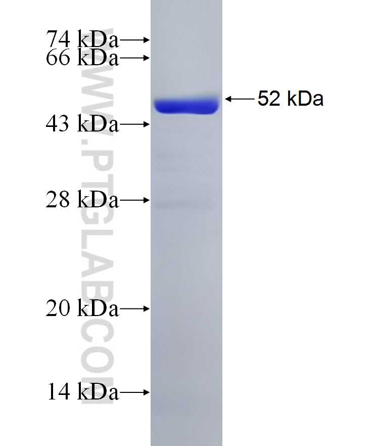 TRIM54 fusion protein Ag15229 SDS-PAGE