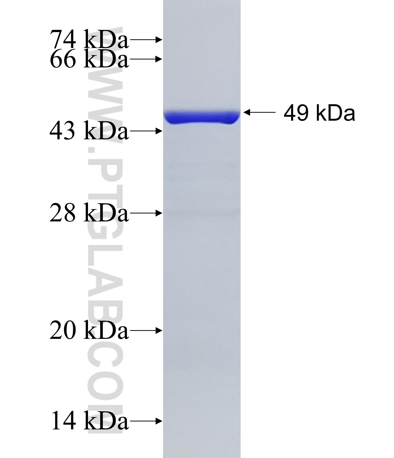 TRIM54 fusion protein Ag15229 SDS-PAGE