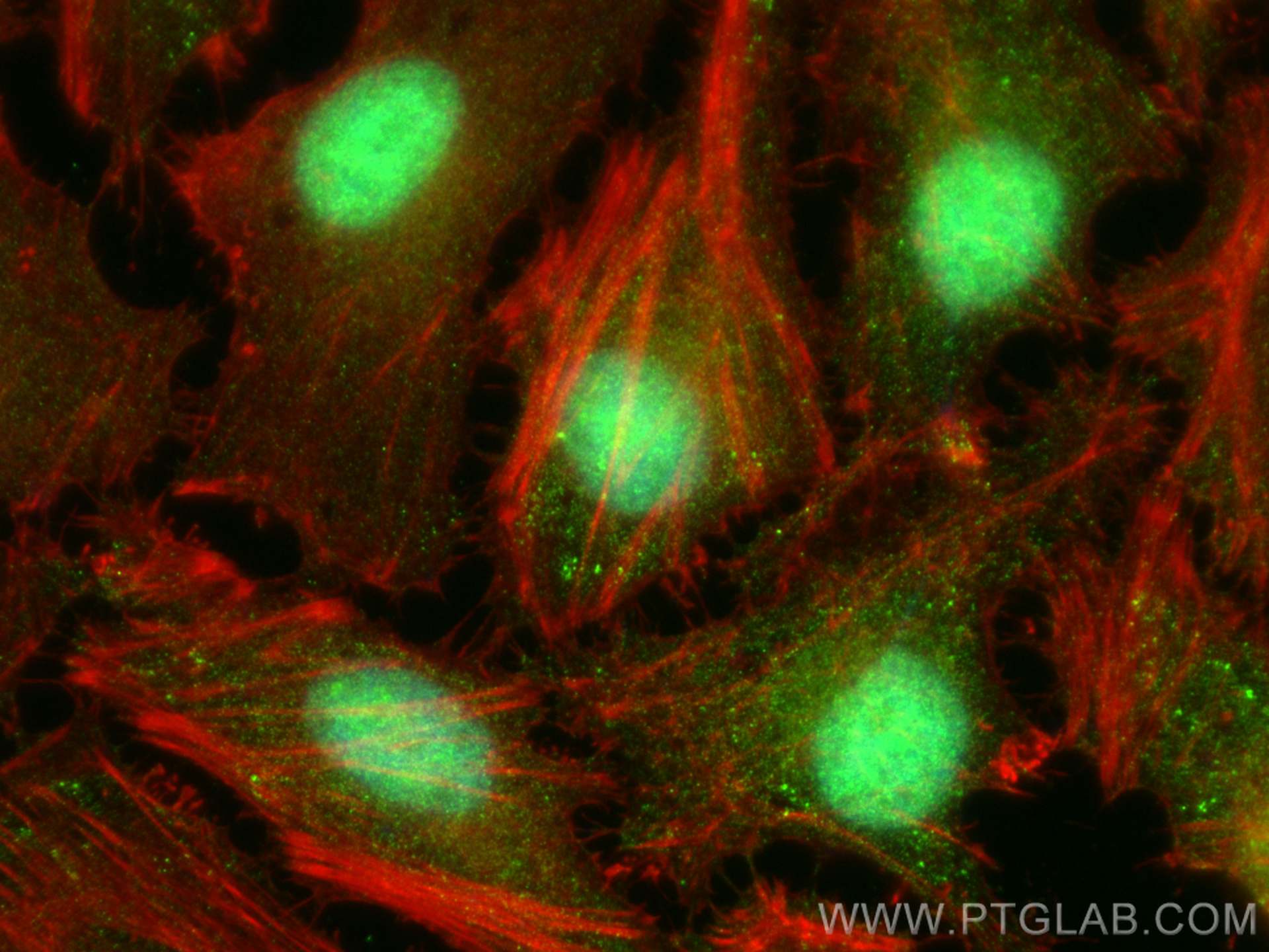 Immunofluorescence (IF) / fluorescent staining of HeLa cells using TRIM55 Polyclonal antibody (27274-1-AP)