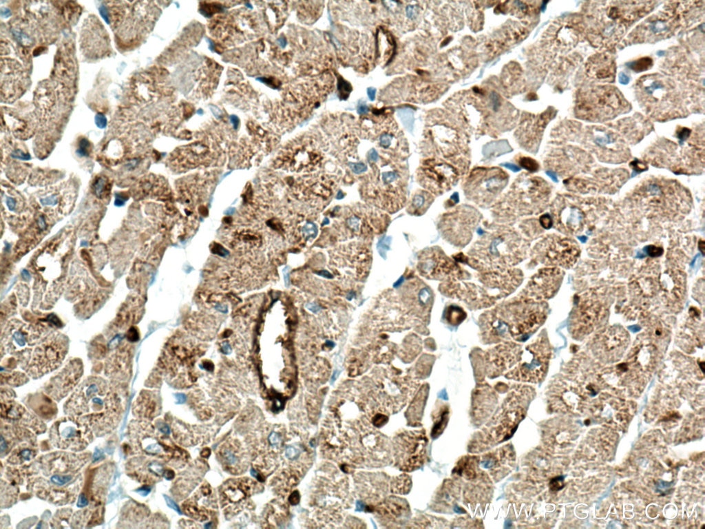 Immunohistochemistry (IHC) staining of human heart tissue using TRIM55 Polyclonal antibody (27274-1-AP)