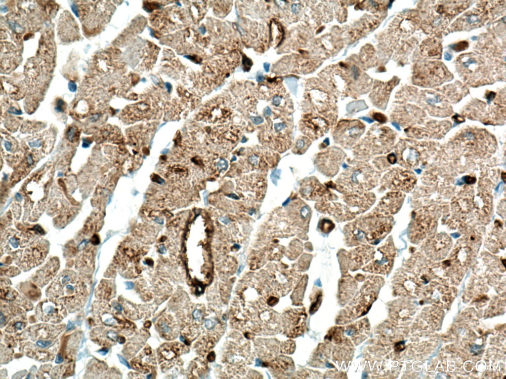 Immunohistochemistry (IHC) staining of human heart tissue using TRIM55 Polyclonal antibody (27274-1-AP)