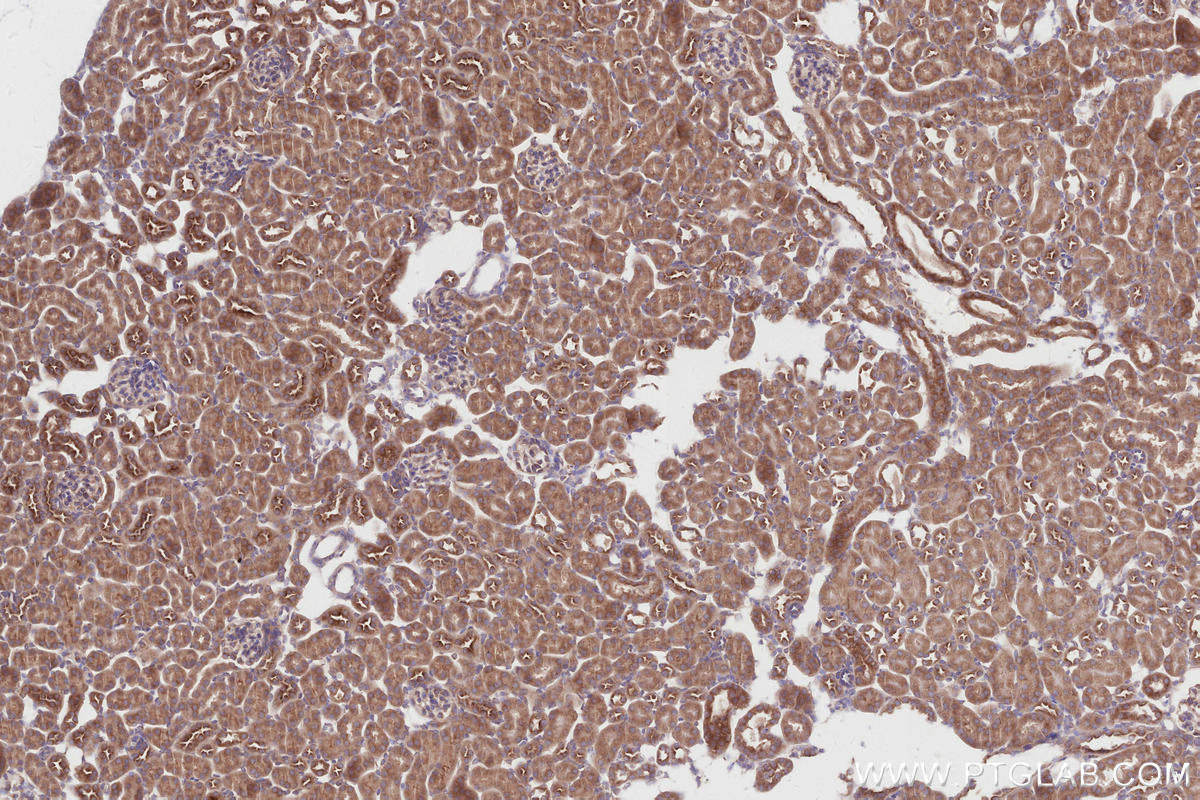 Immunohistochemistry (IHC) staining of mouse kidney tissue using TRIM56 Recombinant antibody (84896-5-RR)