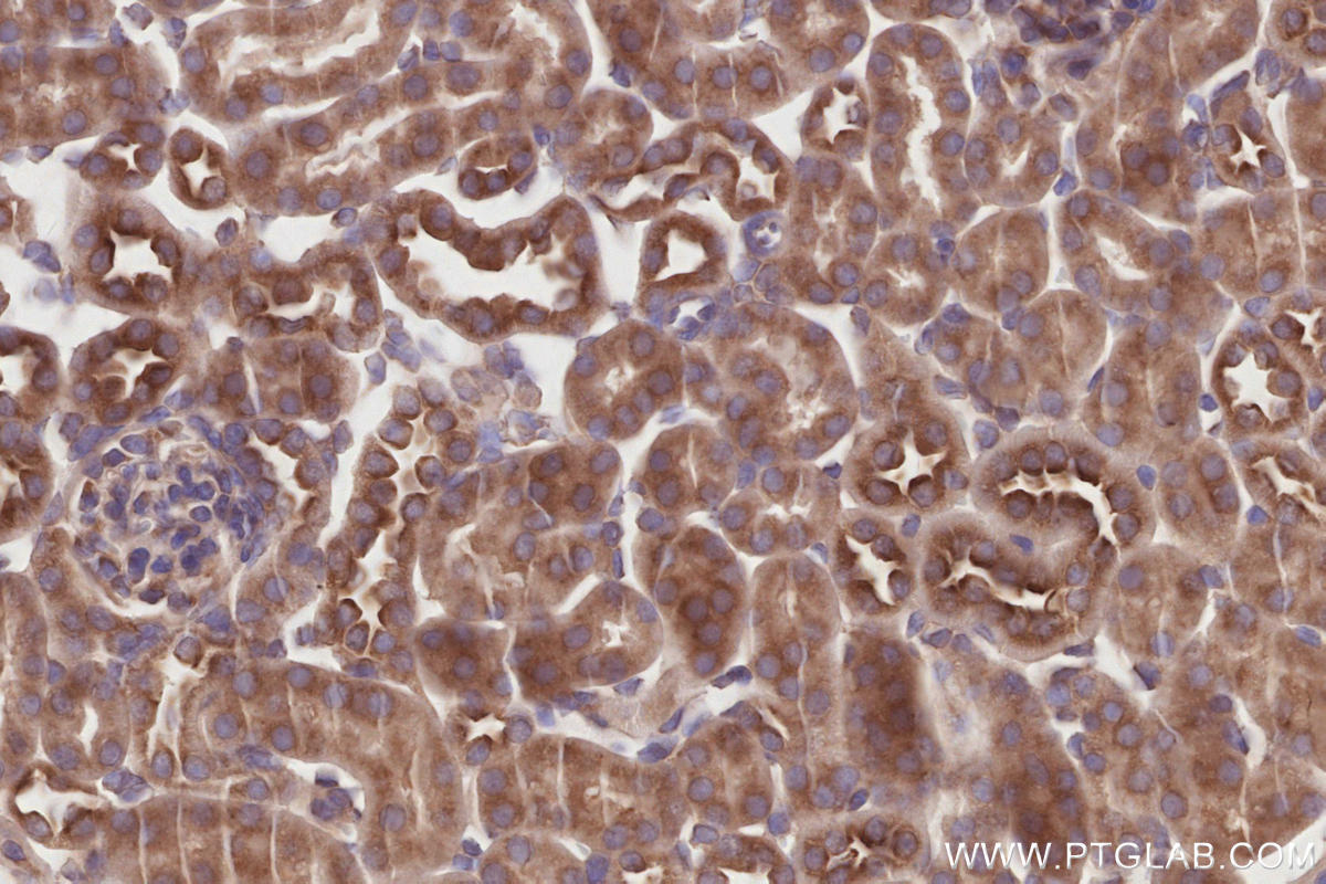 Immunohistochemistry (IHC) staining of mouse kidney tissue using TRIM56 Recombinant antibody (84896-5-RR)