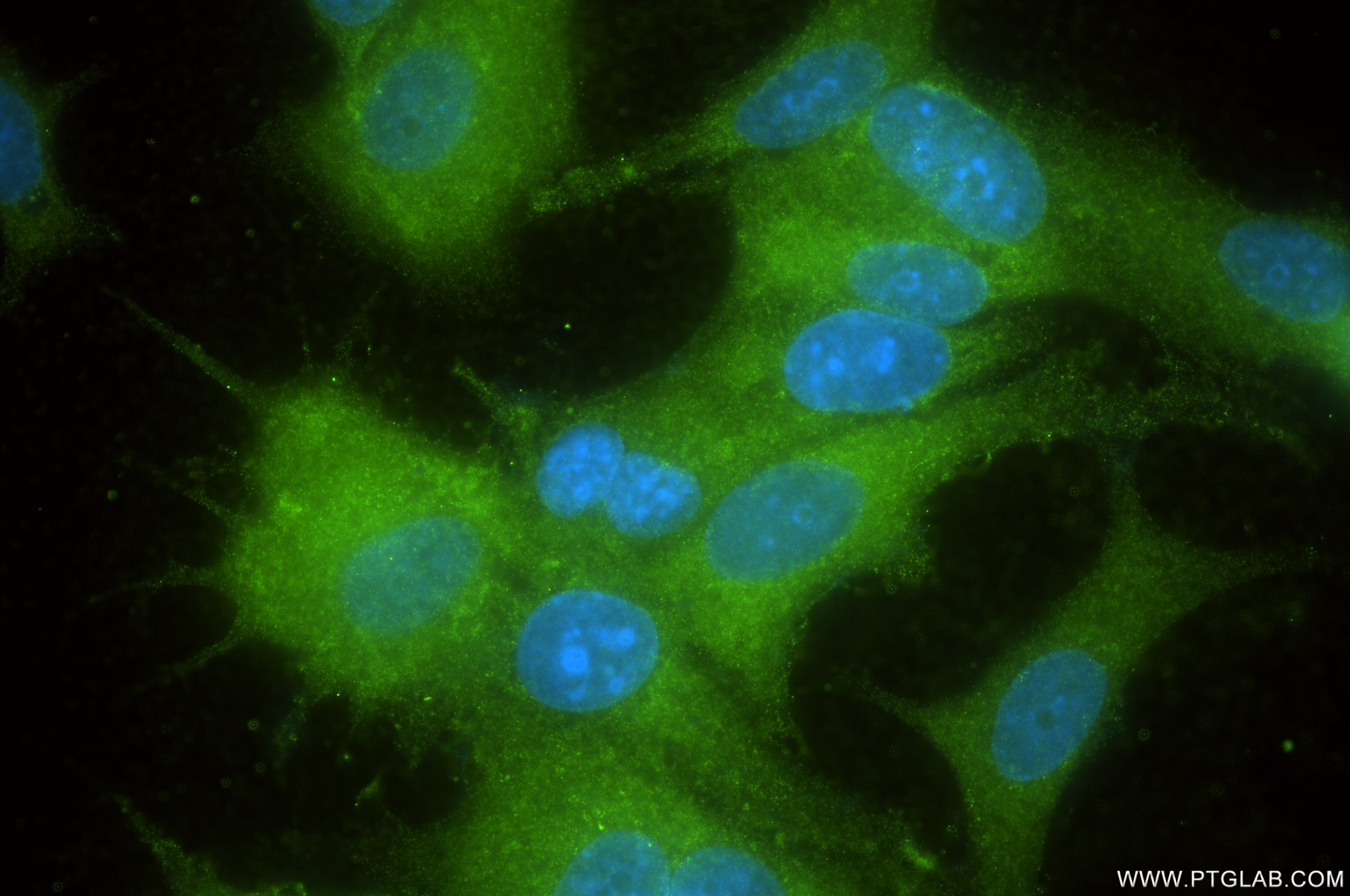 Immunofluorescence (IF) / fluorescent staining of MCF-7 cells using TRIM56 Recombinant antibody (84896-7-RR)