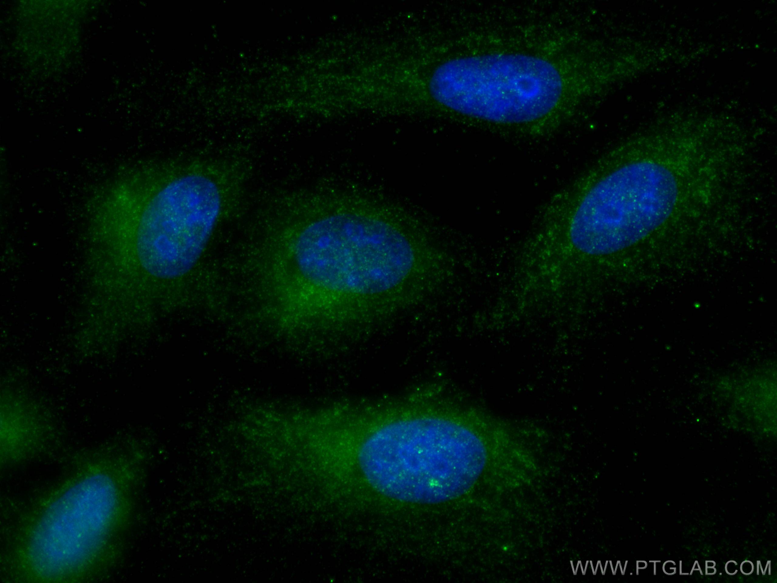 Immunofluorescence (IF) / fluorescent staining of U2OS cells using TRIM59 Polyclonal antibody (28575-1-AP)
