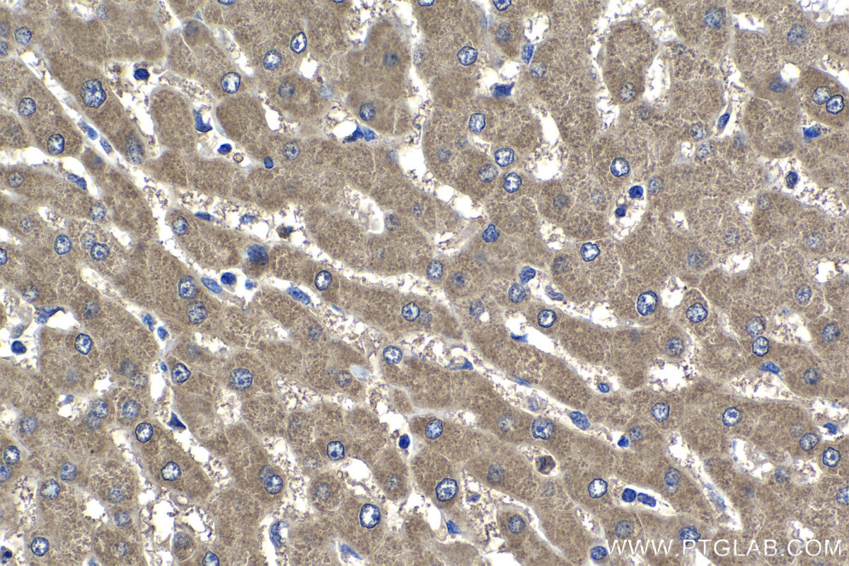 Immunohistochemistry (IHC) staining of human liver tissue using TRIM59 Polyclonal antibody (28575-1-AP)
