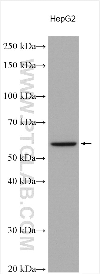 Western Blot (WB) analysis of various lysates using TRIM6 Polyclonal antibody (11953-1-AP)