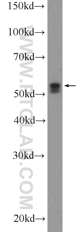 Western Blot (WB) analysis of COLO 320 cells using TRIM6 Polyclonal antibody (11953-1-AP)