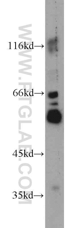 Western Blot (WB) analysis of human liver tissue using TRIM6 Polyclonal antibody (11953-1-AP)