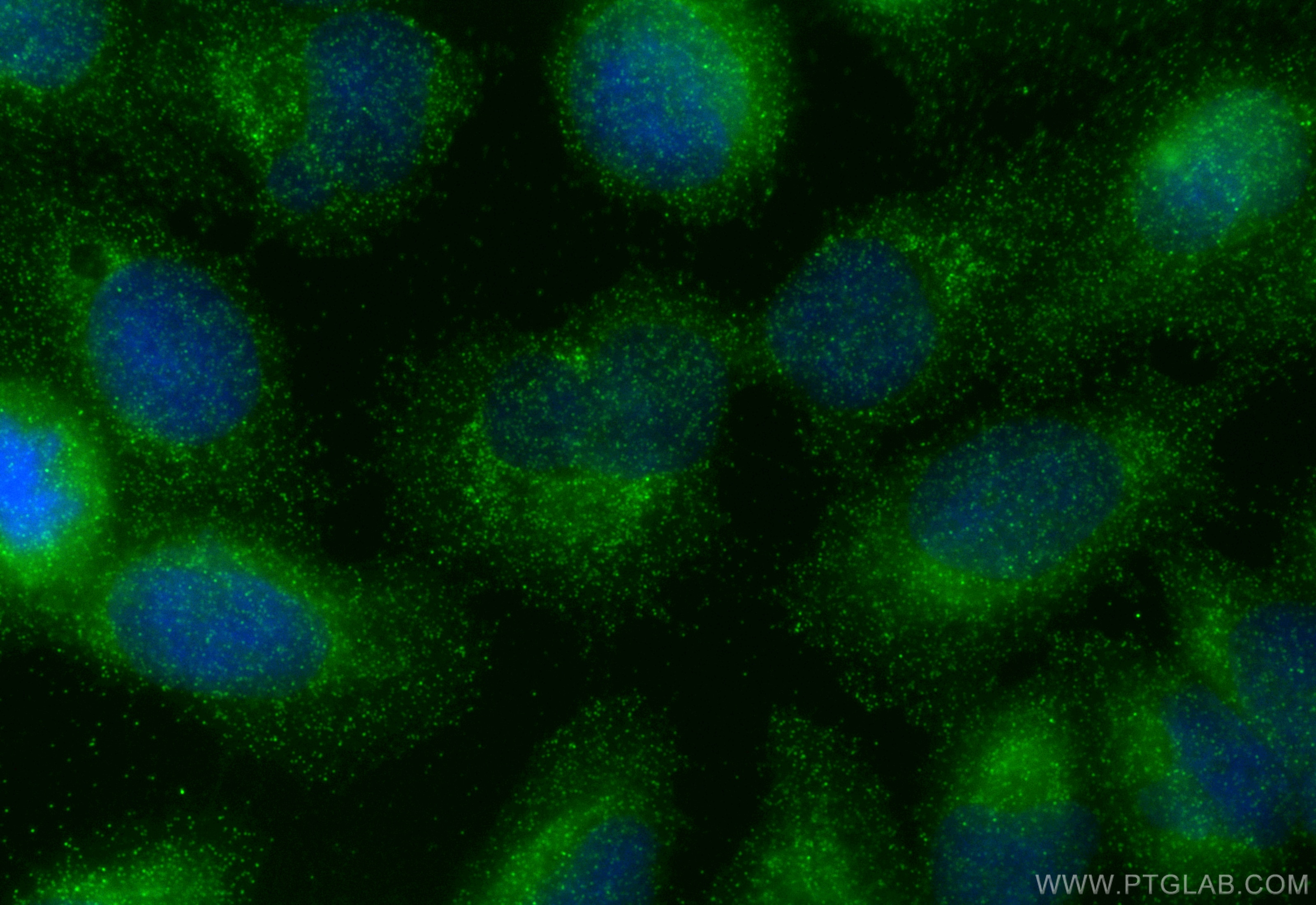 Immunofluorescence (IF) / fluorescent staining of U2OS cells using TRIM61 Polyclonal antibody (24371-1-AP)