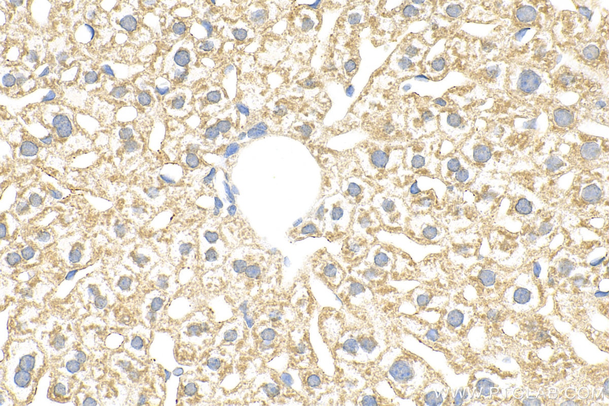 Immunohistochemistry (IHC) staining of mouse liver tissue using TRIM61 Polyclonal antibody (24371-1-AP)