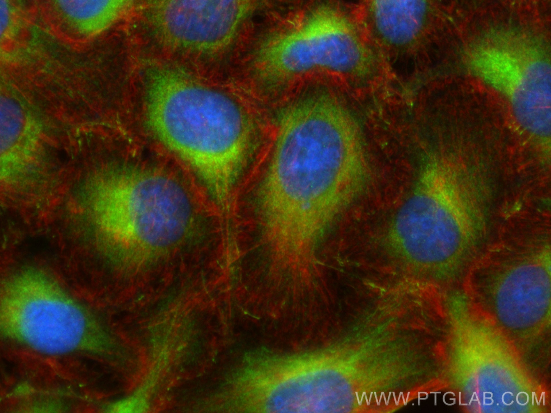 Immunofluorescence (IF) / fluorescent staining of U2OS cells using TRIM62 Polyclonal antibody (15256-1-AP)