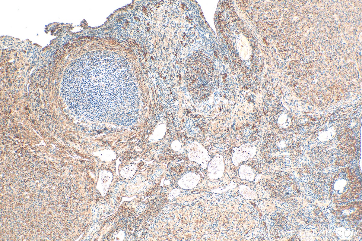 IHC staining of rat ovary using 15256-1-AP