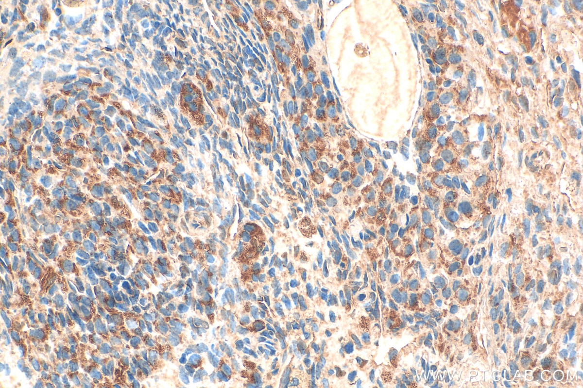 Immunohistochemistry (IHC) staining of rat ovary tissue using TRIM62 Polyclonal antibody (15256-1-AP)