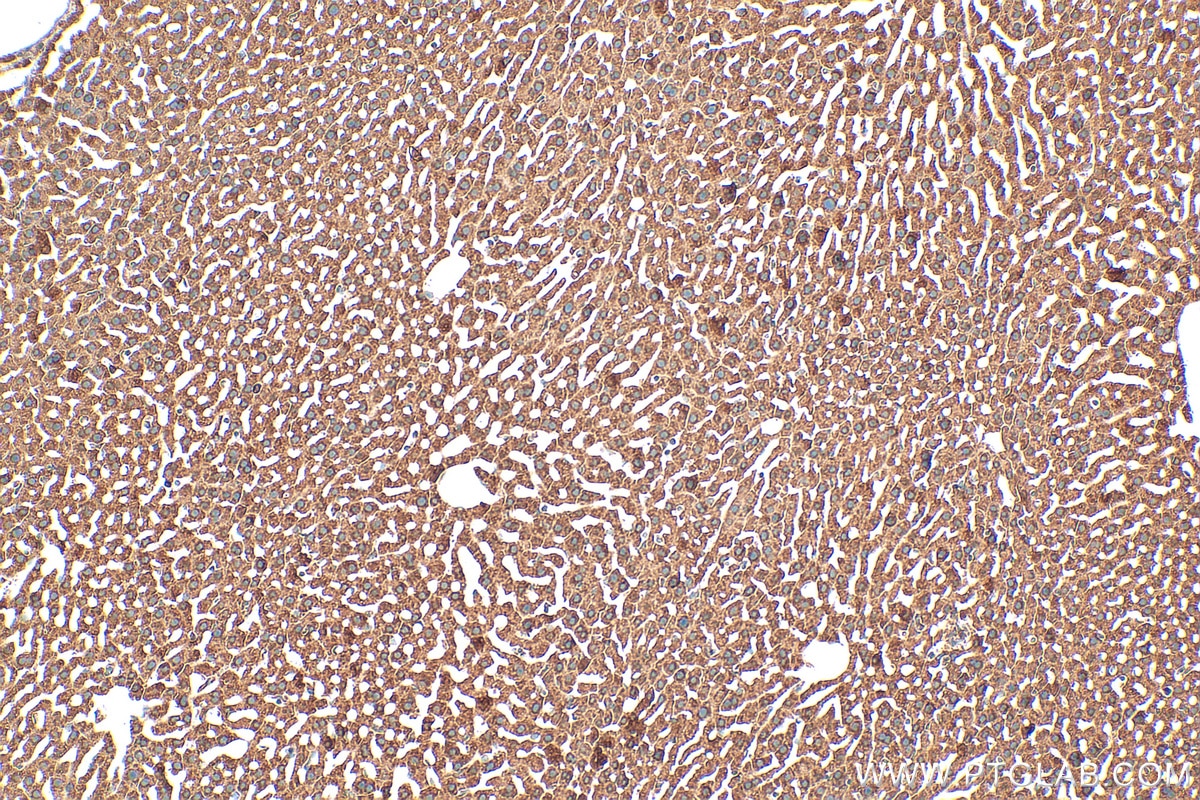 Immunohistochemistry (IHC) staining of mouse liver tissue using TRIM62 Polyclonal antibody (15256-1-AP)