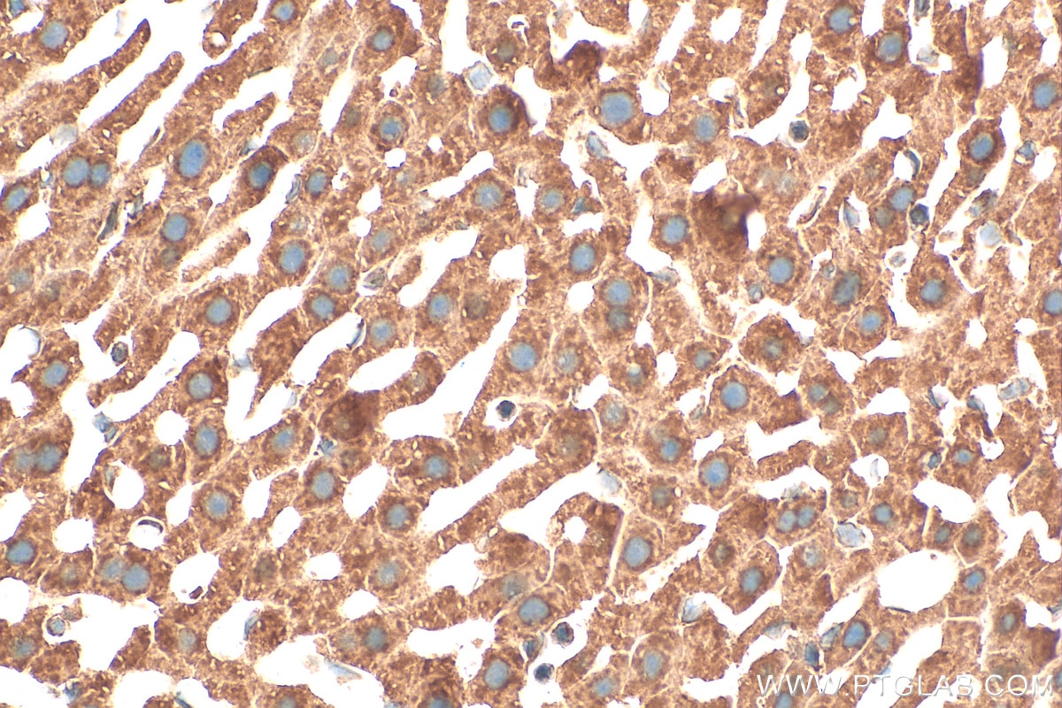 Immunohistochemistry (IHC) staining of mouse liver tissue using TRIM62 Polyclonal antibody (15256-1-AP)