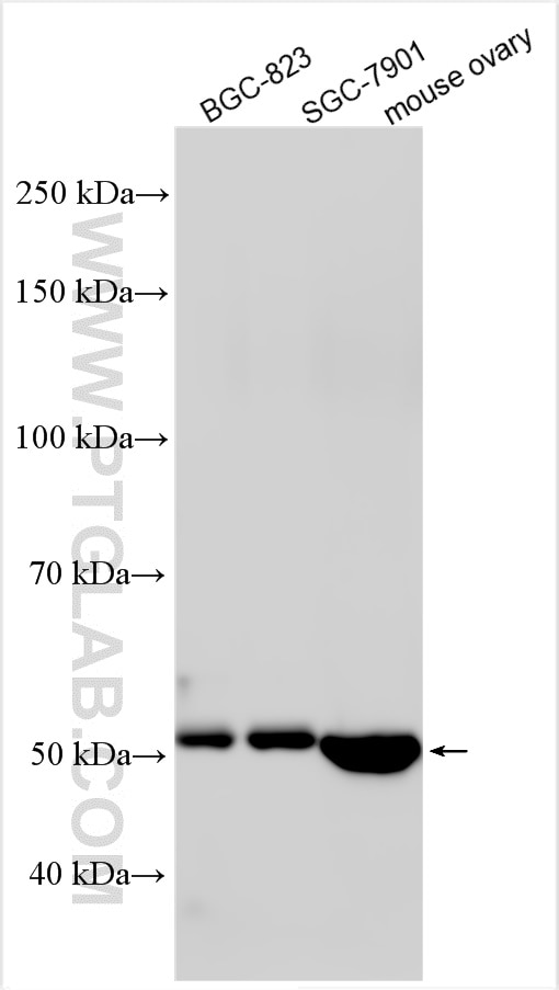 Western Blot (WB) analysis of various lysates using TRIM62 Polyclonal antibody (15256-1-AP)
