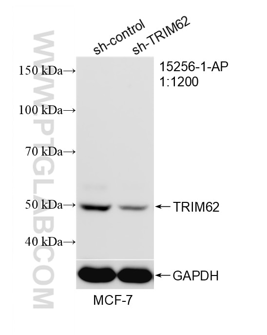 WB analysis of MCF-7 using 15256-1-AP Western Blot (WB) analysis of MCF-7 cells using TRIM62 Polyclonal antibody (15256-1-AP)