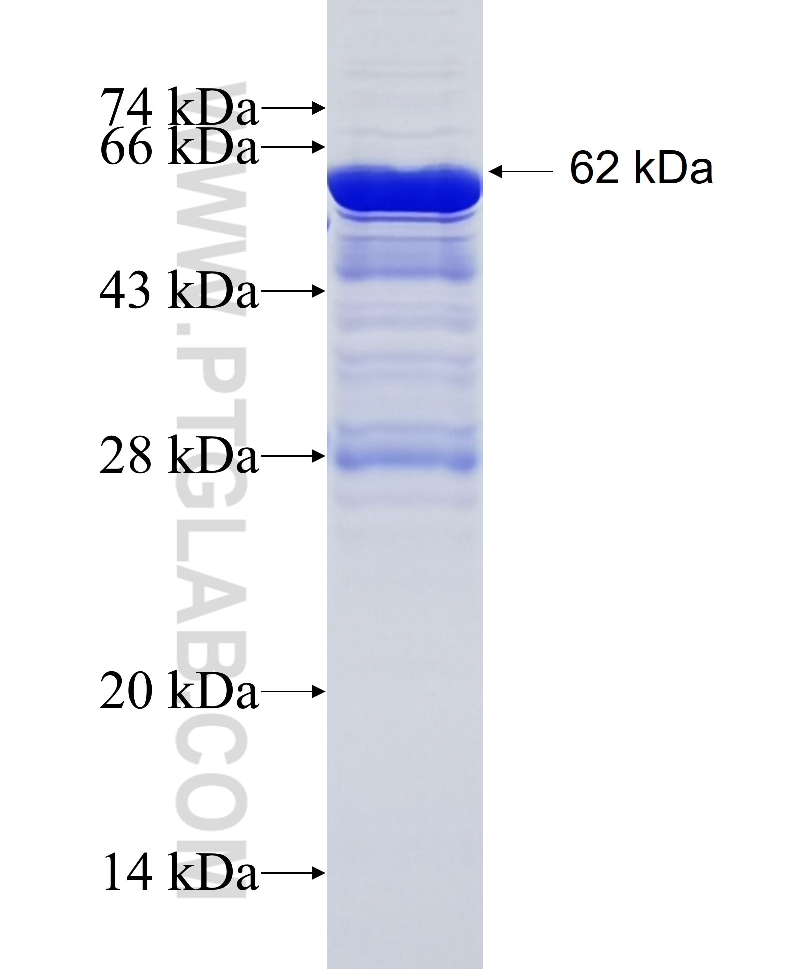 TRIM62 fusion protein Ag7143 SDS-PAGE