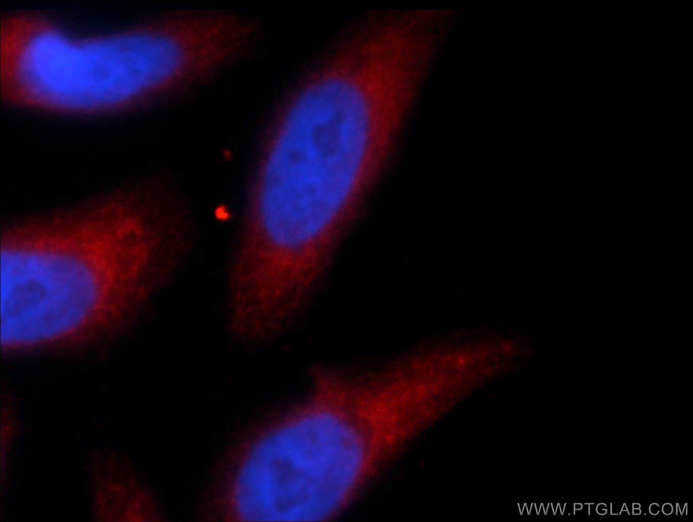 Immunofluorescence (IF) / fluorescent staining of HeLa cells using TRIM63 Polyclonal antibody (55456-1-AP)