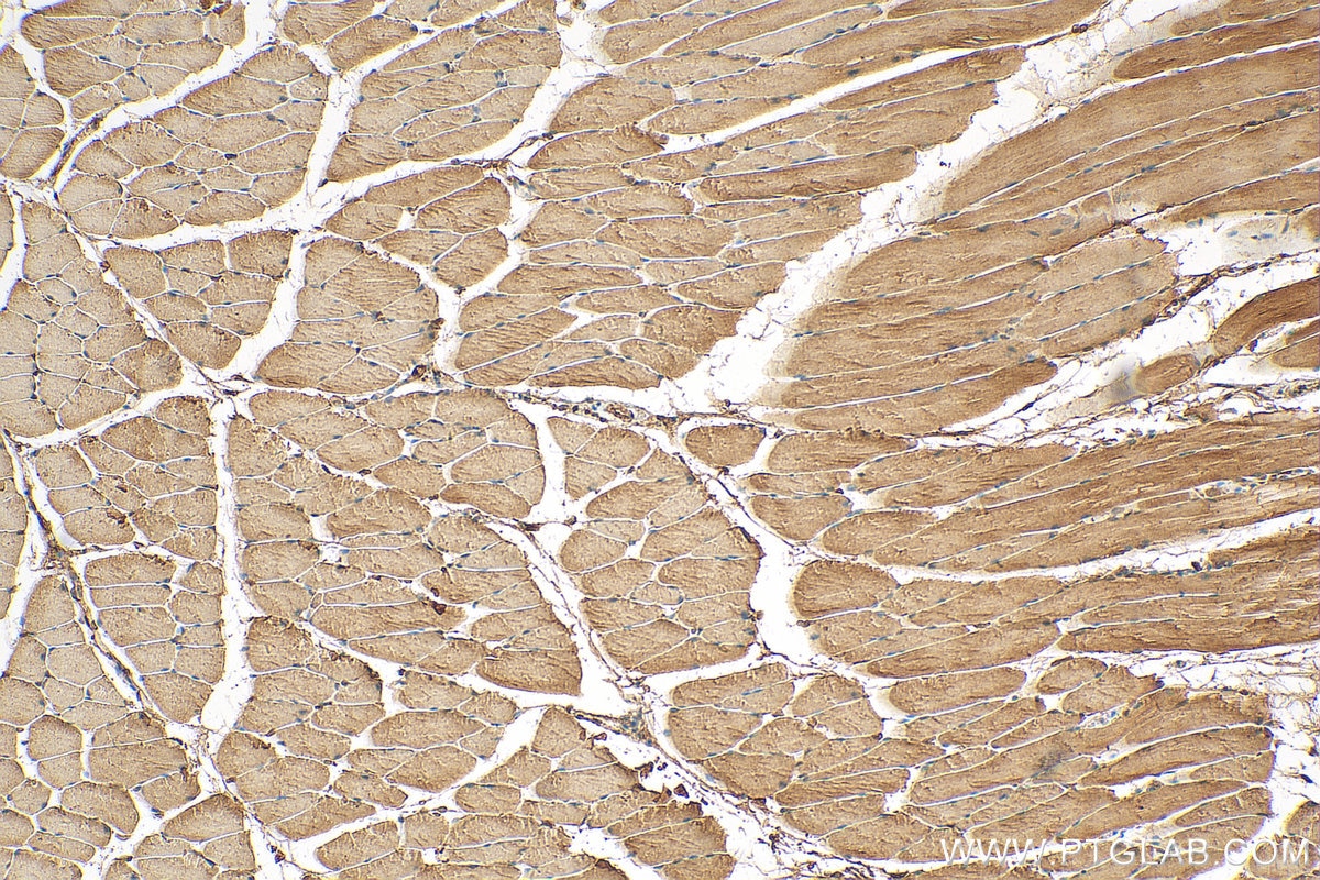 Immunohistochemistry (IHC) staining of mouse skeletal muscle tissue using TRIM63 Polyclonal antibody (55456-1-AP)