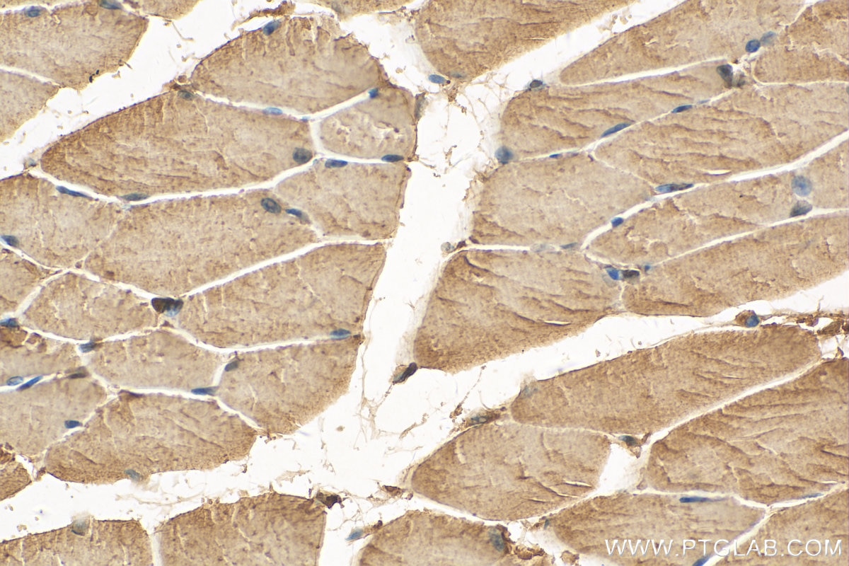 Immunohistochemistry (IHC) staining of mouse skeletal muscle tissue using TRIM63 Polyclonal antibody (55456-1-AP)