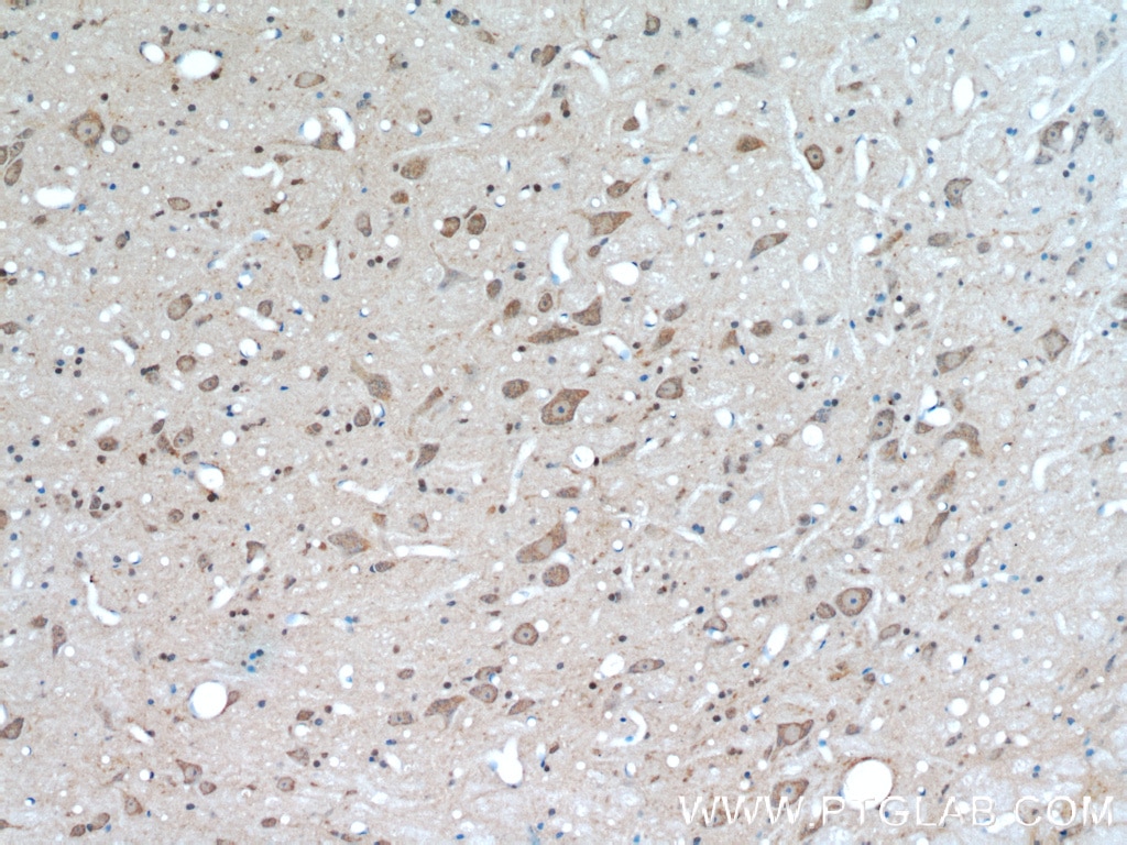 Immunohistochemistry (IHC) staining of rat brain tissue using TRIM63 Polyclonal antibody (55456-1-AP)