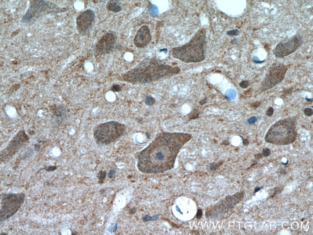 Immunohistochemistry (IHC) staining of rat brain tissue using TRIM63 Polyclonal antibody (55456-1-AP)